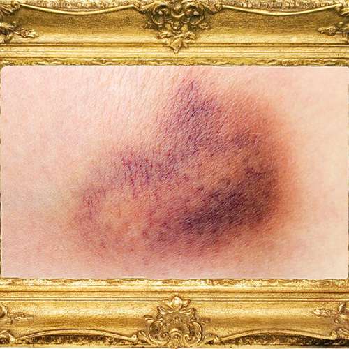 *Hit me if I'm pretty*